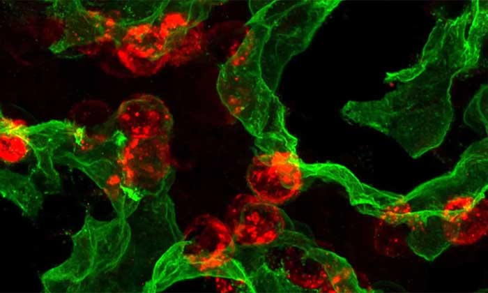 Mayo Clinic discovery reveals how lungs repair themselves, opening doors for regenerative therapies Mayo Clinic discovery reveals how lungs repair themselves, opening doors for regenerative therapies - mayo clinic